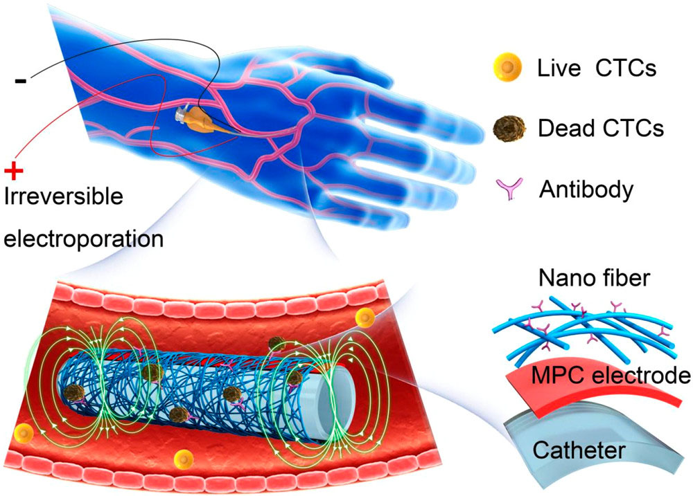 Schematic Diagram of In Vivo Enrichment and Elimination of CTCs Using the Flexible Electronic Catheter