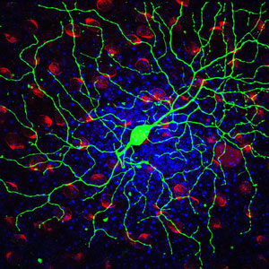 Mouse Retinal Ganglion Cell