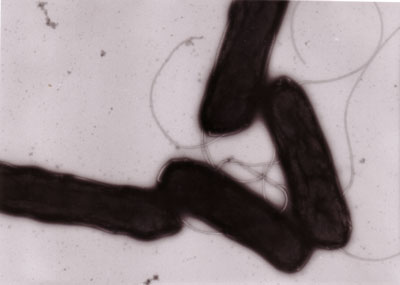 >Transmission-Electromicroscopic picture of Yersinia-Bacteria
