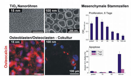 Einfluss von Oberflächengeometrien im Nanometerskalenbereich auf Mesenchymale Stammzellen