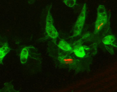 Confocal microscope image showing insect immune cells (green) containing E.coli bacteria (red).