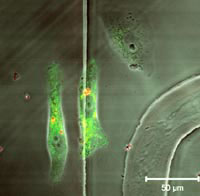 Konfokale Mikroskopieaufnahme des Inneren zweier Zellen (grün). Die Mikroshuttle sind orange, der Zellkern erscheint dunkel