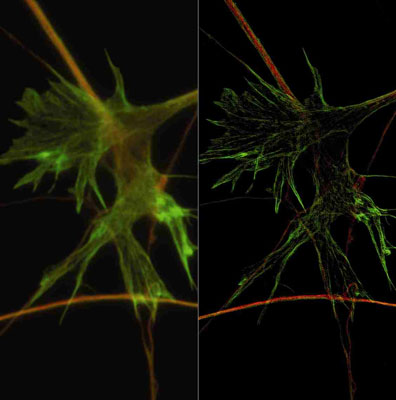 Photograph of neuronal growth cone with widefield microscopy (left) and SR-SIM