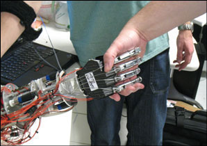 smarthand prosthetic hand