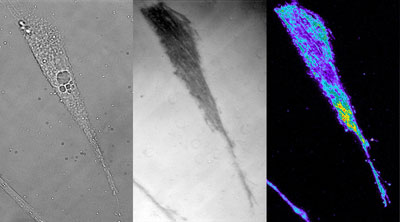 TIRF Mikroskop erlaubt ungekannte Einblicke in Muskelzellen