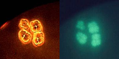 Eine Aufnahme des Archaeons Methanosarcina mazei unter dem Lichtmikroskop (links) und unter dem Fluoreszenzmikroskop (rechts)
