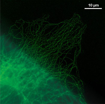 Sichtbar gemacht ist hier das Zellskelett, dessen Gerüst aus Mikrotubulin mit fluoreszierenden Farbstoffen markiert wurde