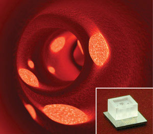 The endothelial progenitor cell detection chip (inset) could be used in the assessment of plaque build-up in blood vessels