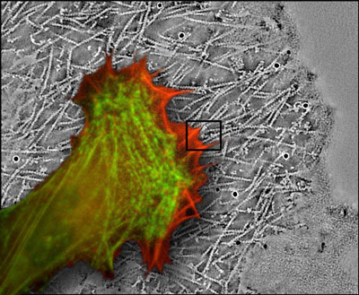 Lebende Bindegewebszelle im Fluoreszenzmikroskop, die vordere Zone der Bewegung in rot