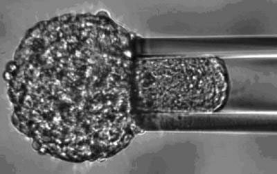 Sucking a small sample into a pipette is a simple technique to discover the mechanical properties of tissue