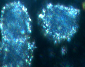 A dark-field confocal microscopy image of live breast cancer cells with SERS nanotags attached to an antibody