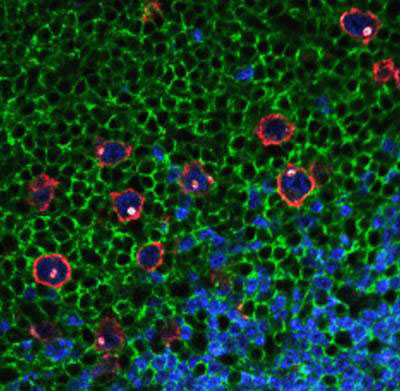 Reed-Sternberg cells can be distinguished by their red outline, blue and white internal staining, and their lack of green staining
