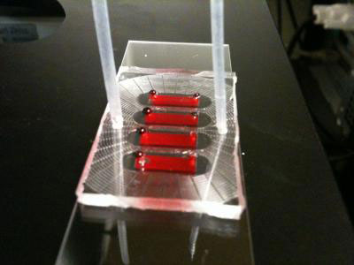 Microfluidic Blood Test