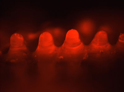 This image shows microneedles that have partially dissolved one minute after being pressed into pig skin