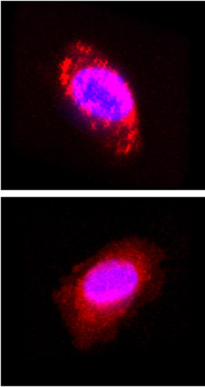 Figure 1: Confocal microscopy images of a brain cancer cell labeled using aldehydes (top) and succinimidyl esters (bottom) as fluorescent dye precursors. Nuclei are shown in blue.