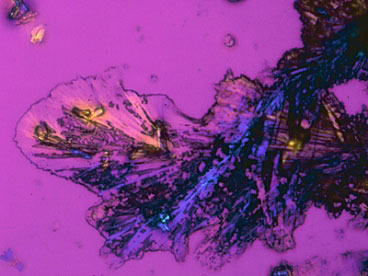 Crystals of cisplatin, a platinum compound that is used as a chemotherapy drug, are shown here
