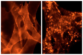 On the left, a group of FAP-labeled cells glow orange in the presence of a fluorogen dye. After the cells are treated with an agonist that activates the G protein-coupled receptors, the receptors move to the inside the cell, leaving many fewer on the surface, as shown in the image on the right.