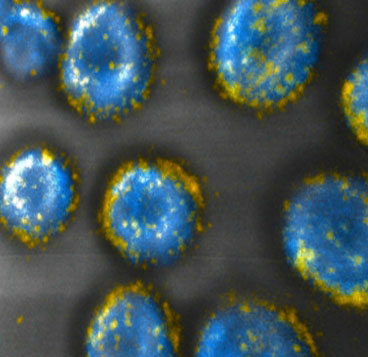 MIT engineers have developed a way to attach drug-carrying pouches (yellow) to the surfaces of cells