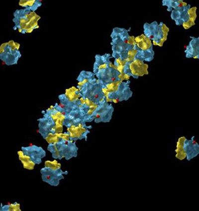 Dreidimensionale Rekonstruktion einer Proteinfabrik mittels Kryo-Elektronentomographie