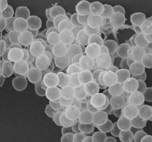 A scanning electron micrograph of porous silica microspheres filled with perfluoropentane vapor
