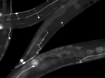 MIT engineers have developed a way to rapidly perform surgery on single nerve cells in the worm C. elegans. The white lines represent axons — long extensions of nerve cells that carry messages to other cells