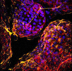 This is a confocal microscopic image of a 3-D lung cell culture labeled with various markers for cell differentiation