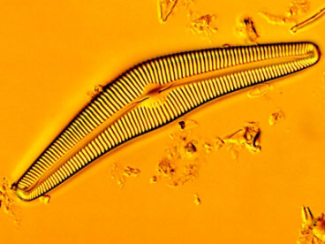 An image of a species of diatom, Cymbela cistula