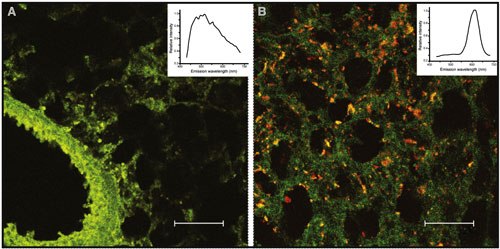 The left image shows lung tissue injected with doxorubicin alone, while the image on the right (yellow dots) indicates the increased uptake of the quantum-dot delivered drug