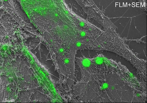 Fluorezenzmarkierung und SEM - Virusproteine auf Zelloberfläche