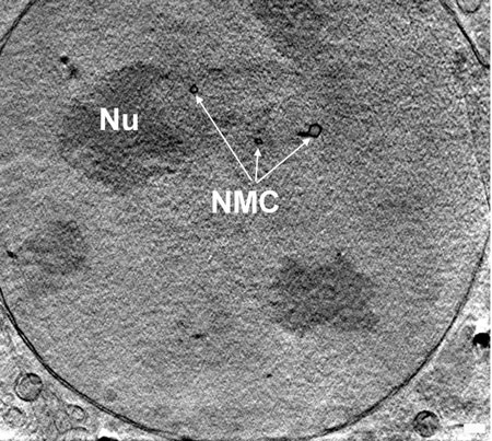 Der 3-D-Schnitt durch den Kern einer Adenokarzinom-Zelle einer Maus zeigt den Nukleolus (NU) und die quer durch den Kern verlaufenden Membrankanäle (NMC) mittels Röntgen-Nanotomographie.