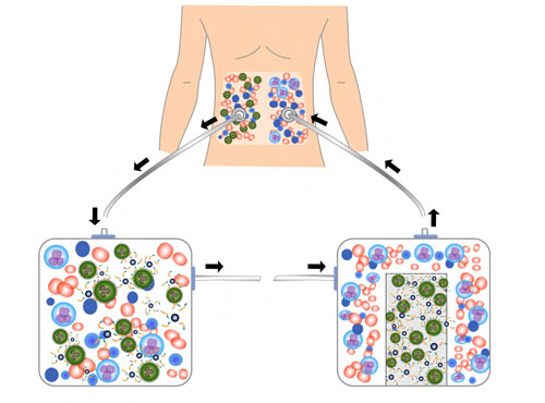 Schematic of magnetic nanoparticle treatment