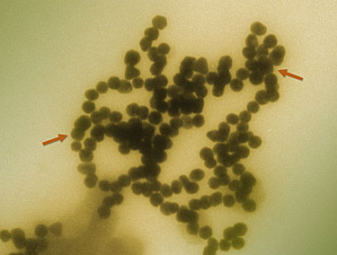 Transmission electron micrograph of gold nanoparticles clustering in solution