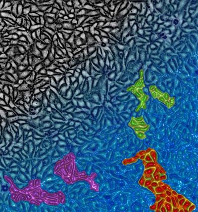 This is an artist's representation of epithelial cells (black) approaching the glass transition (blue)
