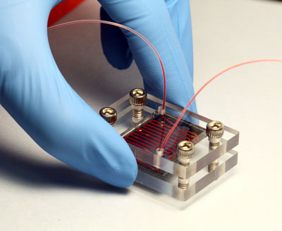 A integrated chip for detecting circulating tumor cells in blood collected from prostate cancer patients