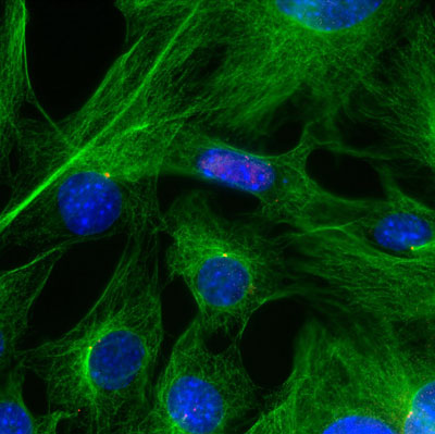 Shown are healthy mouse cells with flurorescent staining of the nucleus (blue) and microtubules (green) emanating from the microtubule organizing center (red)