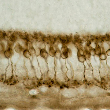 An image of rod bipolar cells in human retina