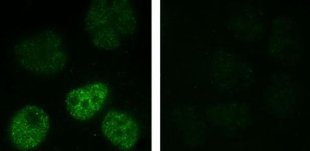 nickel nanoparticles inside lung cells