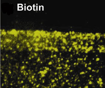 Gold nanoparticles in a lipid membrane