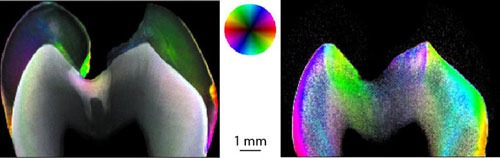 Dichte und Orientierung von 60 bis 70 nm grossen Nanostrukturen am Zahn