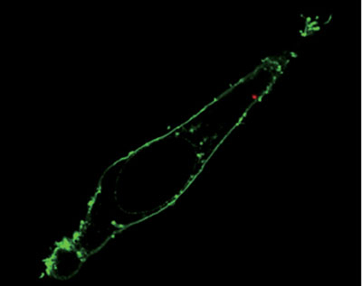 Fluorescence confocal image of a single living HeLa cell