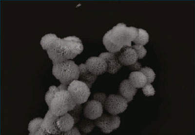 A cluster of microsponges made of long strands of folded RNA