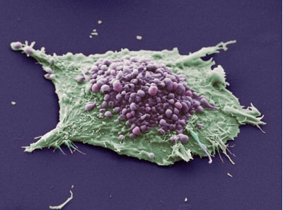 lung-cancer cell
