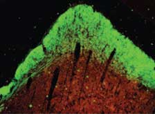 Nerve cell regrowth shows a damaged area of the brain that has been repaired