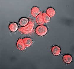 Fluorescence image of cells treated with nanoflares