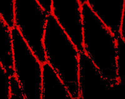 Magnetic nanoparticles loaded into endothelial cells show a red fluorescent glow
