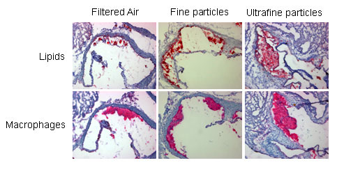 Exposure to ultrafine particles shows highest degree of plaques