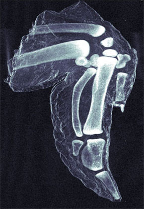 darkfield x-ray