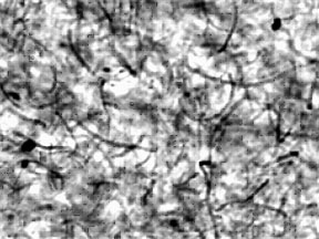 Confocal microscope image of a carbon nanotube/polypropylene composite