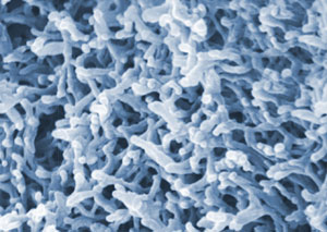  worm-like nanostructure