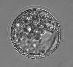A mouse embryo at the fifth day of development cultured in a 1 microliter droplet